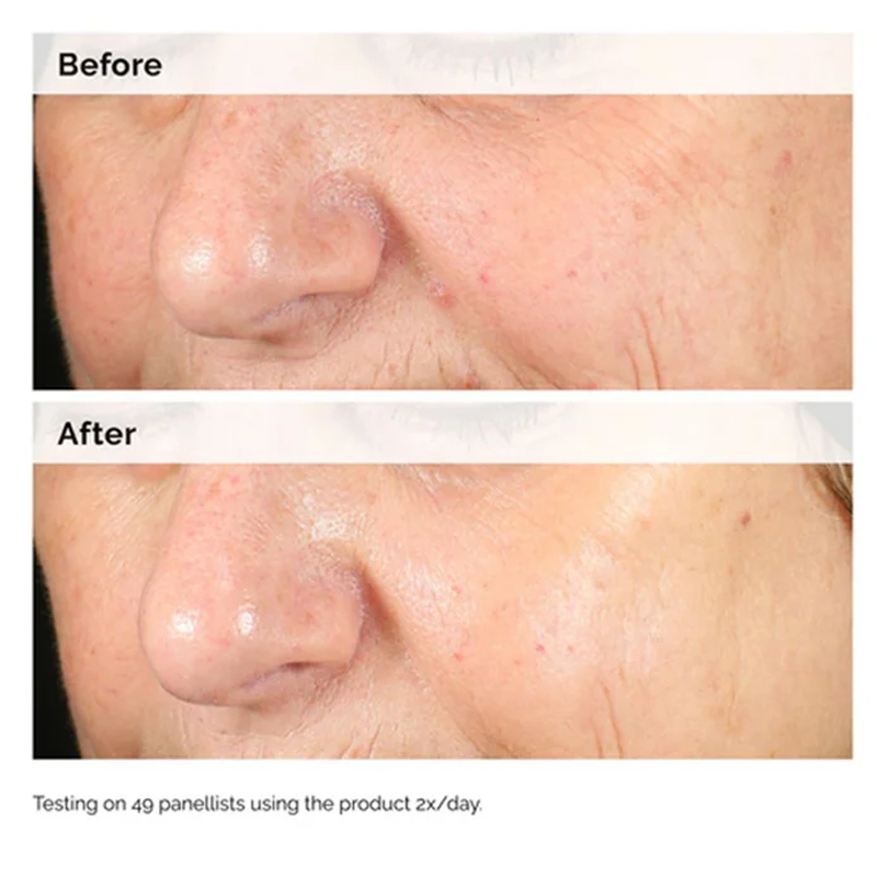Alpha Arbutin 2% + HA 30ml Sie - Aha Bha Exfoliant recensione e prezzo