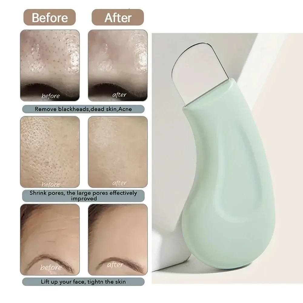 Strumento per la Rimozione di  - Skincare Routine recensione e prezzo