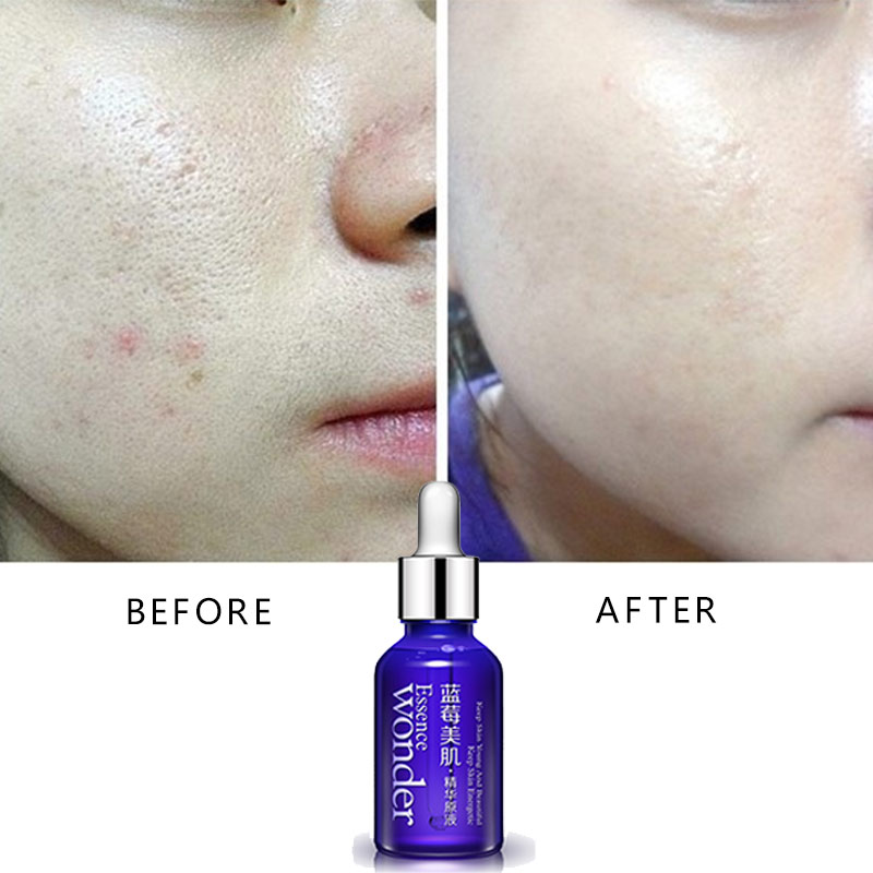 BIOAQUA siero Lifting viso mir - Skincare Garnier recensione e prezzo