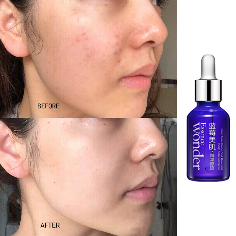 BIOAQUA siero Lifting viso mir - Skincare Garnier recensione e prezzo
