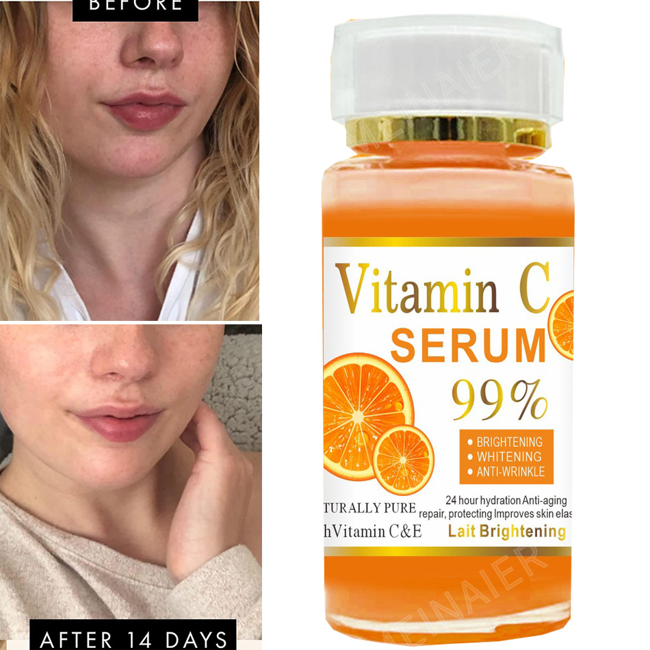120ml 99% vitamina C siero oli - Skincare Garnier recensione e prezzo