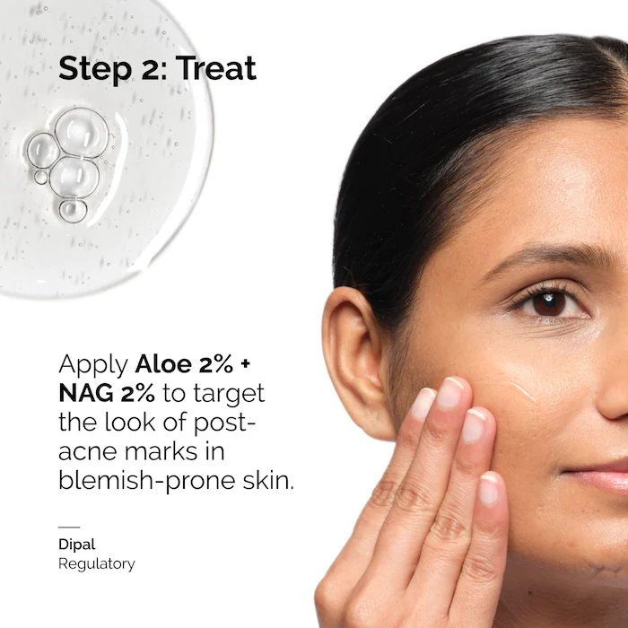 Aloe 2% + Soluzione NAG 2% Sie - Aha Bha Exfoliant recensione e prezzo
