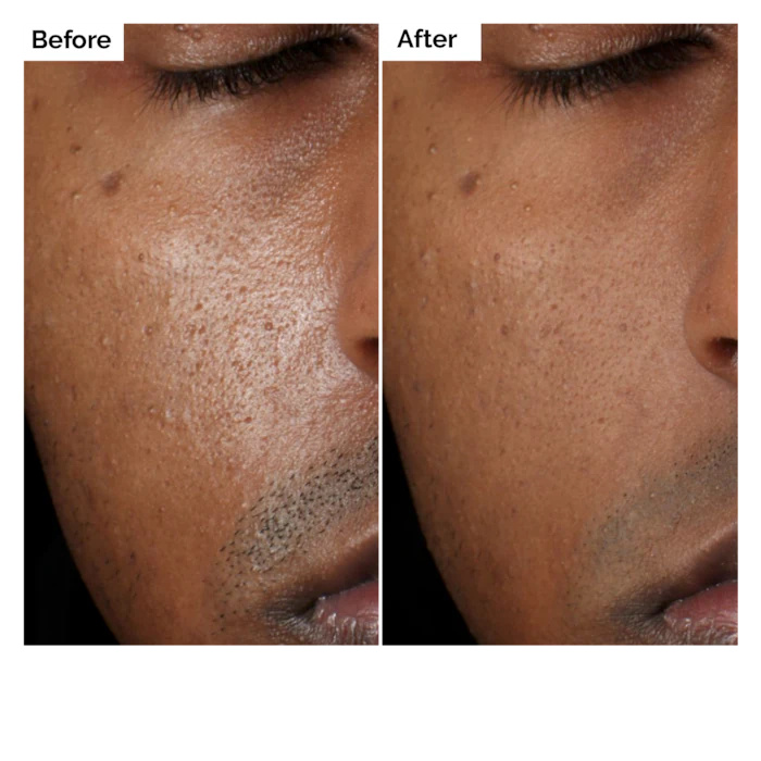 Aloe 2% + Soluzione NAG 2% Sie - Aha Bha Exfoliant recensione e prezzo
