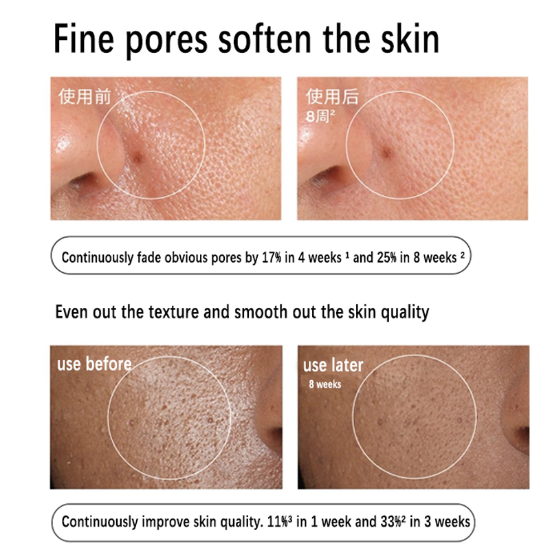 Siero Soluzione Aloe 2% + NAG  - Aha Bha Exfoliant recensione e prezzo